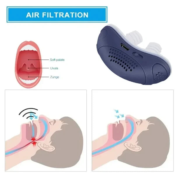 Slaaploos, maskervrij, Micro-CPAP Anti-Snurken