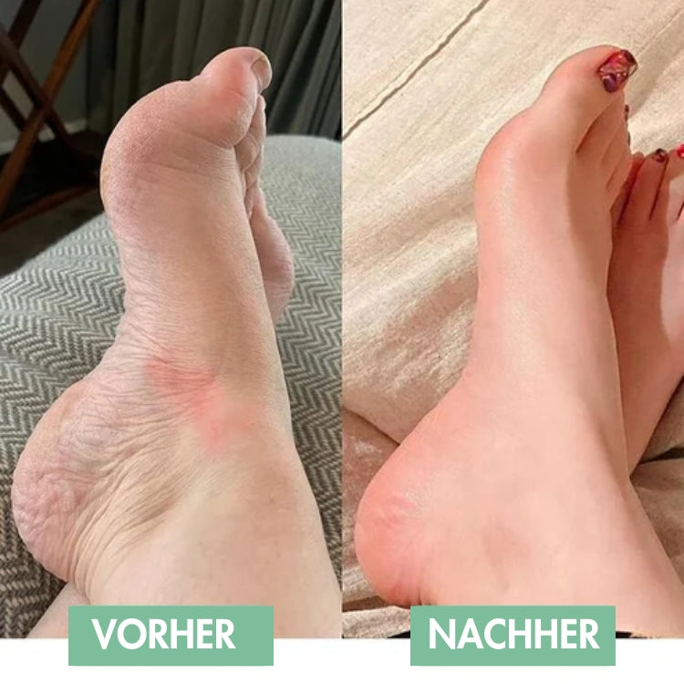 Revivax™ | De innovatieve EMS-voetmassage voor directe verlichting!