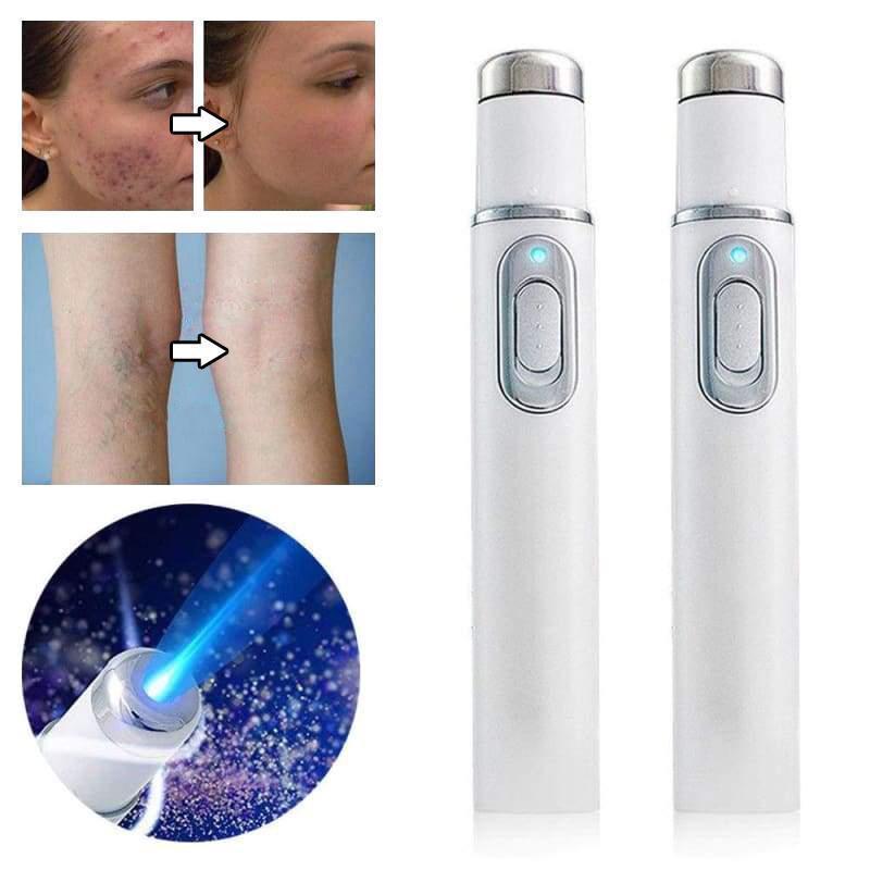 Laserbehandeling-Stift Blu-Ray ongewenste acne verwijderen