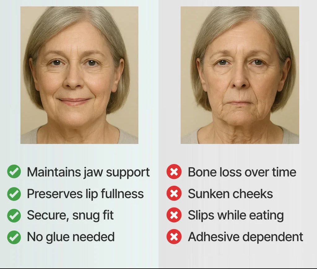 DentalKit - Natuurlijke Look en Gevoel Zonder de Tandarts!