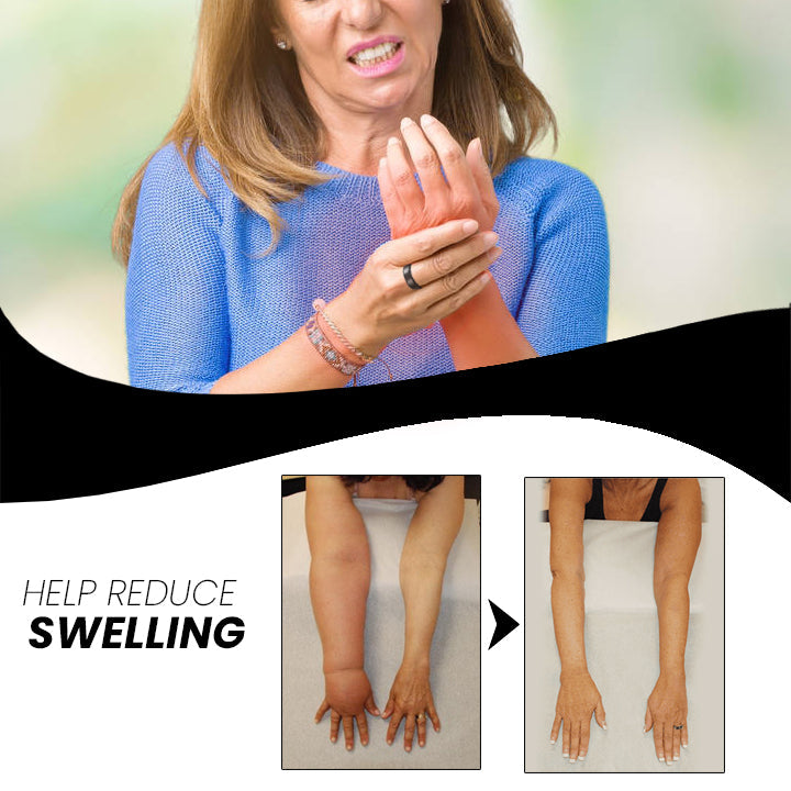 Acupressuur Ring | Handmassage Stimulatie | Verstelbare Comfort Ring | MagnetischeTherapie
