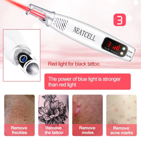 LumiDerm Thuis Laser Pen Voor Het Verwijderen Van Tattoos, Moedervlekken En Vlekken