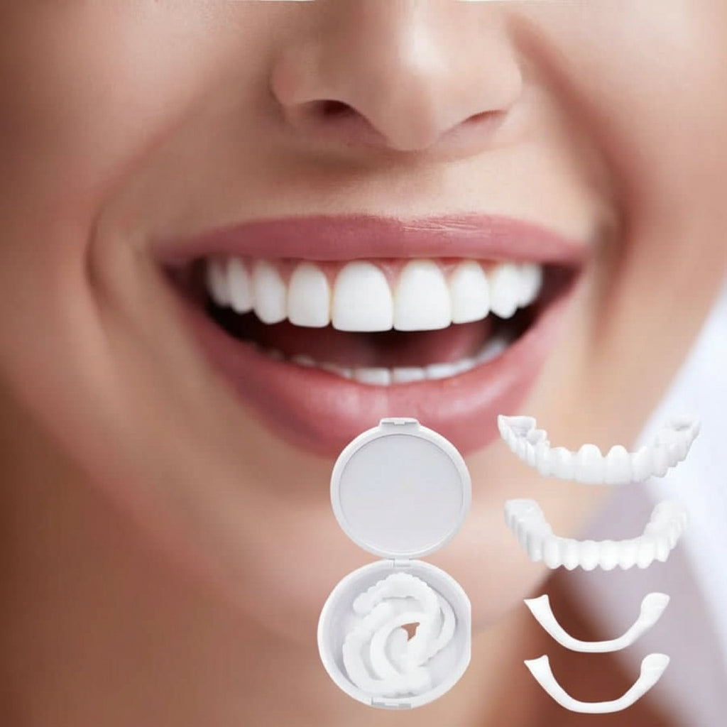 SNAPFIT SMILE – Tandrestauratie voor een perfecte glimlach zonder tandarts