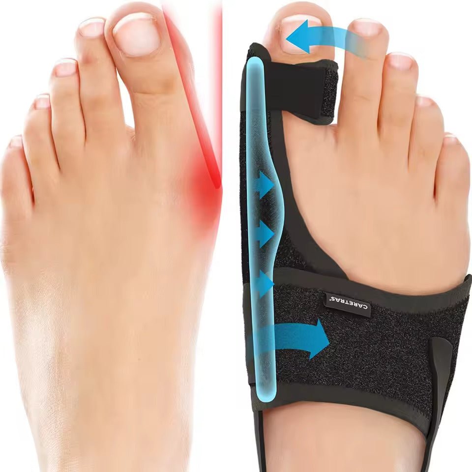 Nachtschiene Hallux Valgus - Ergonomisch en verstelbaar Comfort
