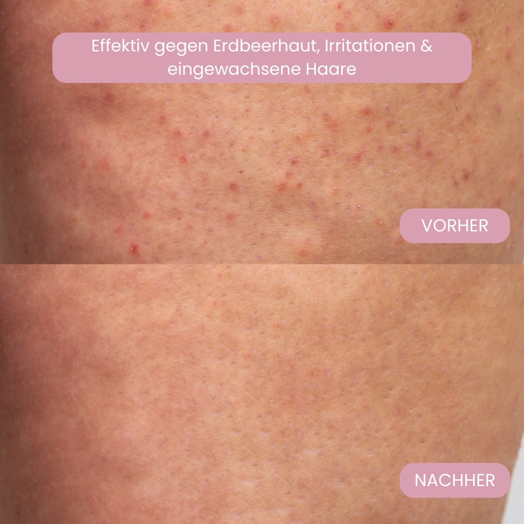 Intiem scheerapparaat voor vrouwen | Elektrisch dames scheerapparaat voor het intieme gebied | Bikini Trimmer | Femora