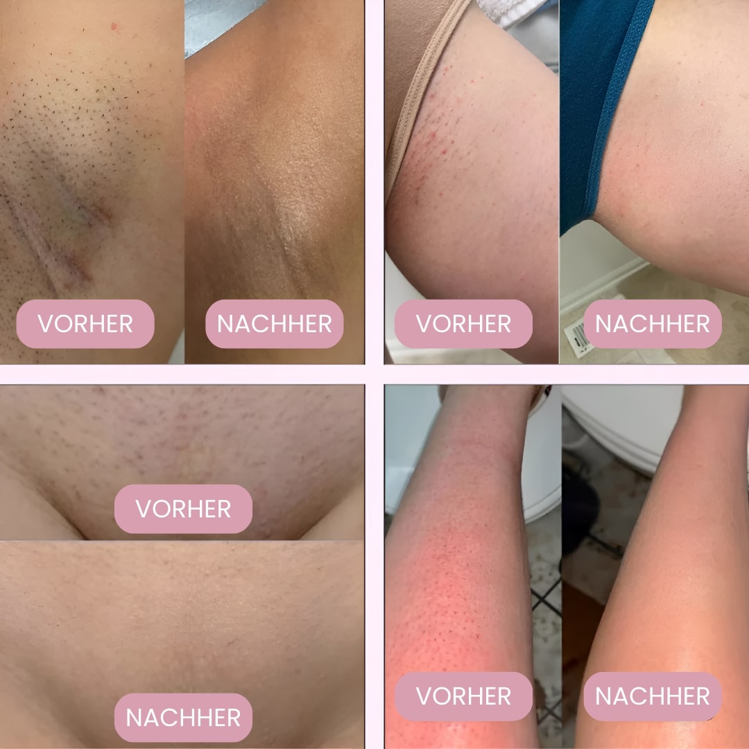 Intiem scheerapparaat voor vrouwen | Elektrisch dames scheerapparaat voor het intieme gebied | Bikini Trimmer | Femora