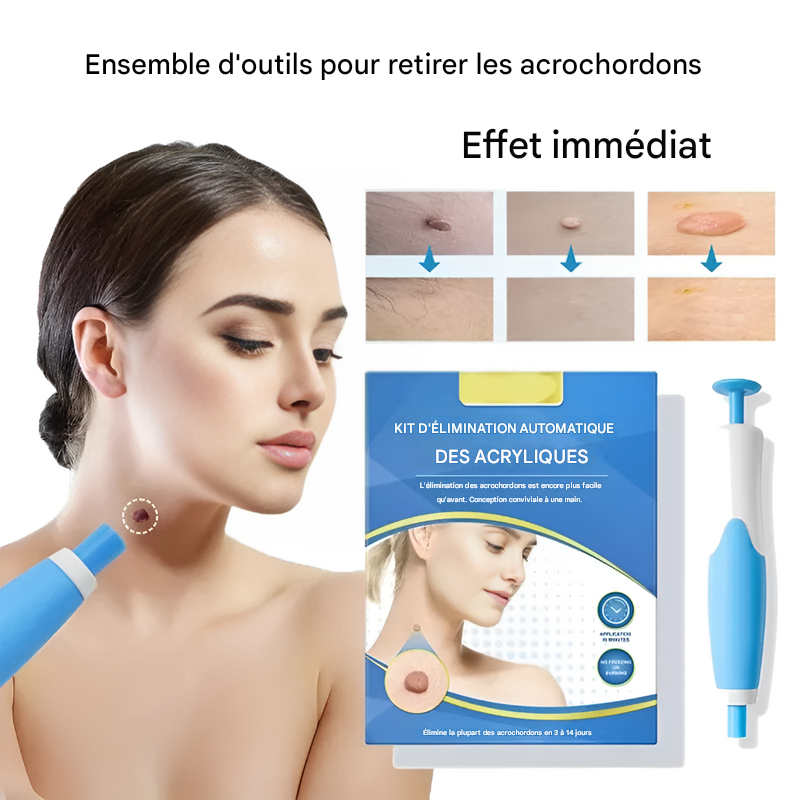 Verwijderingskit voor Acrochordons - Eenvoudige Cryotherapie