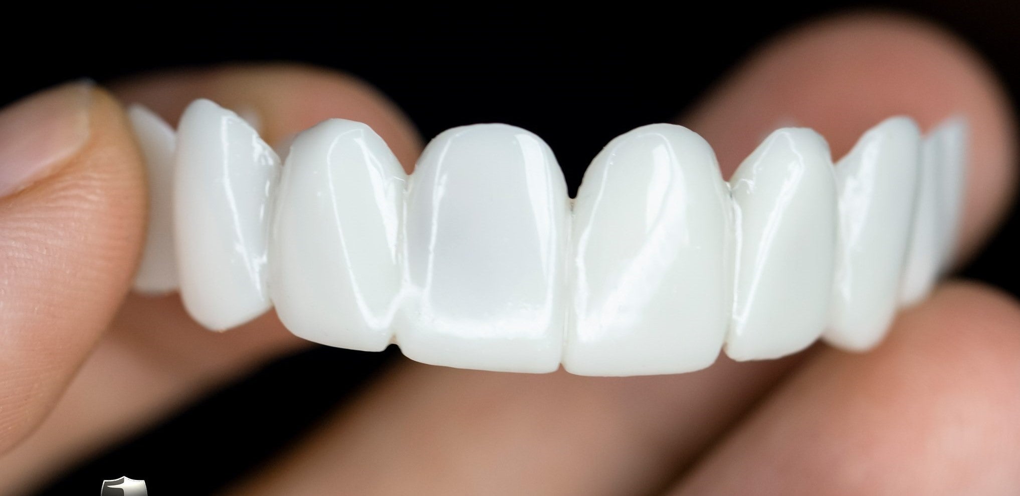 Verwijderbare Tandveneer met Natuurlijke Uiterlijk voor een Esthetische Glimlach
