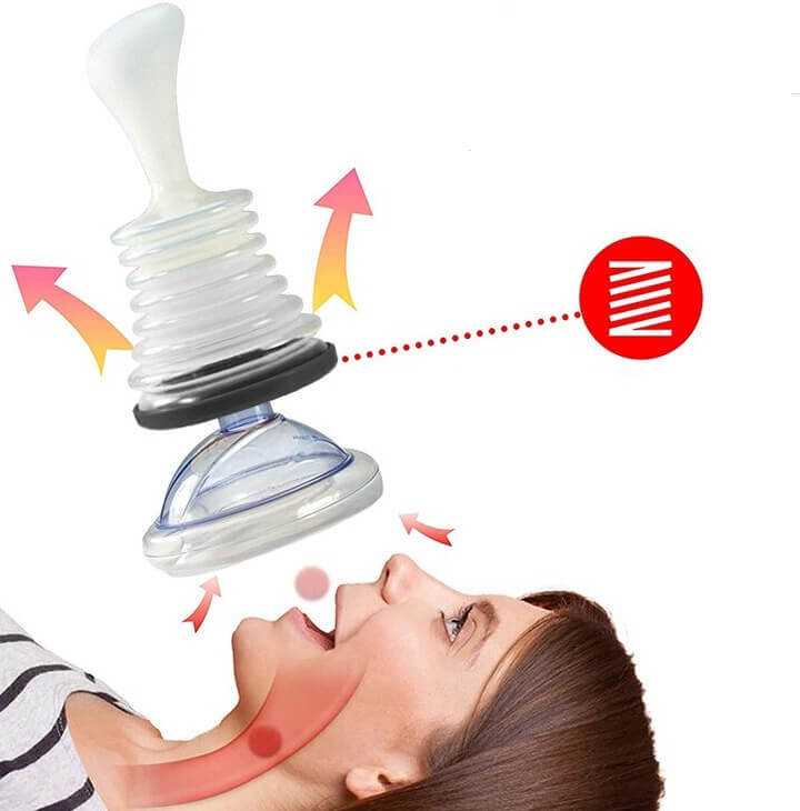 Nood Choke Kit
