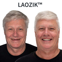 DentalKit - Natuurlijke Look en Gevoel Zonder de Tandarts!