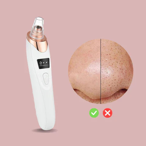 50% Korting | PoreGlow™ | Mee-eter Verwijderaar