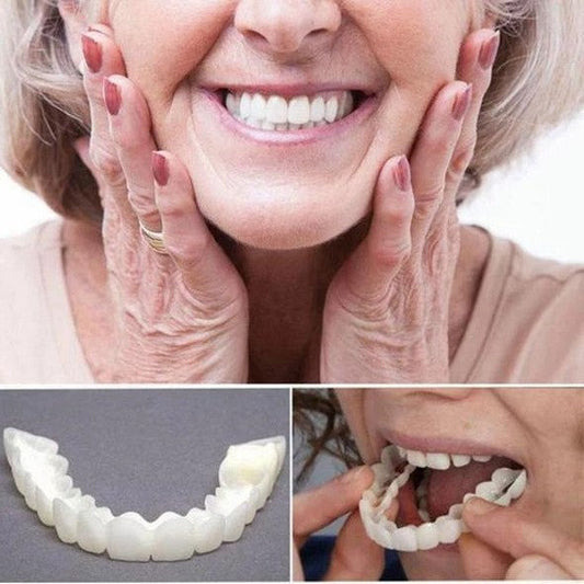 Op Smile Veneers (boven- en onderkaak inbegrepen)
