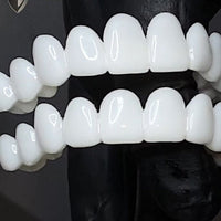 Verwijderbare Tandveneer met Natuurlijke Uiterlijk voor een Esthetische Glimlach