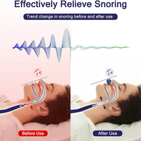 Micro CPAP Slaapapneu-apparaat voor Reizen & Anti-Snurken - CPAP-Alternatief