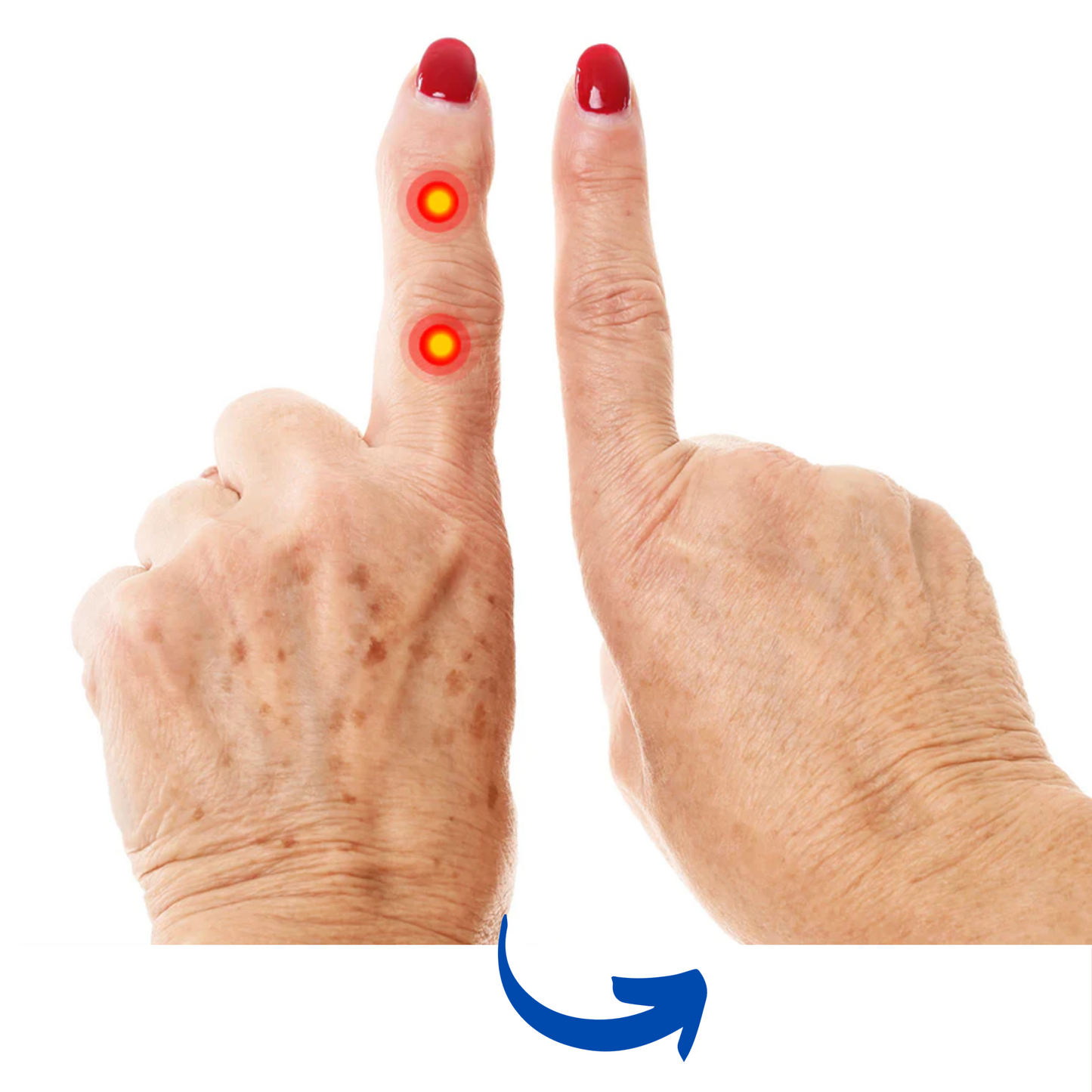 ArthroGlow Near Infrared Handtherapie Handschoenen Voor Artritis Pijnverlichting