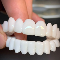 Tandprothese