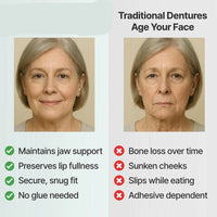 DentalKit - Natuurlijke uitstraling en gevoel zonder de tandarts!