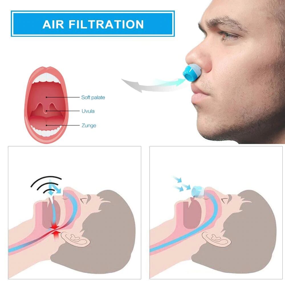 Brehn | Anti-Snurkapparaat | Slangloos, maskervrij Micro-CPAP