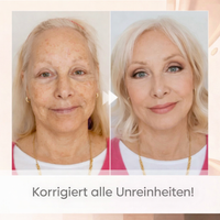 Concealer | Foundation Kleurverandering | Natuurlijke Teint | AgelessGlow