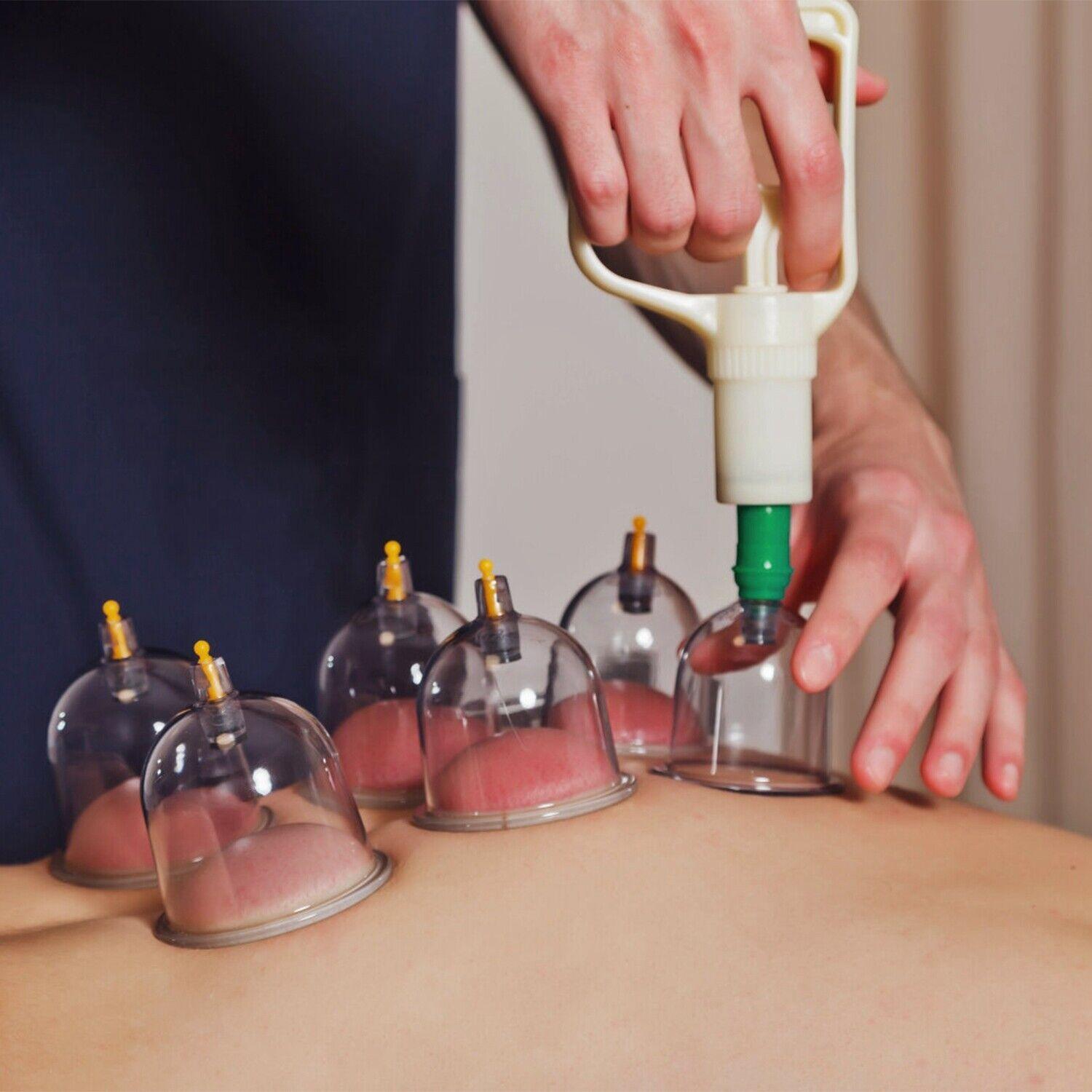 CuppingThera Pro | Set van 32 Stuk Therapie met Cups voor Massage en Acupunctuur