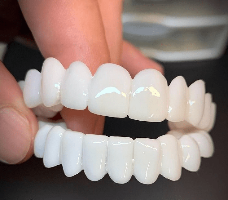 DenturaFlex | Aanpasbare Tandprothese met Natuurlijke Uiterlijk voor Comfort