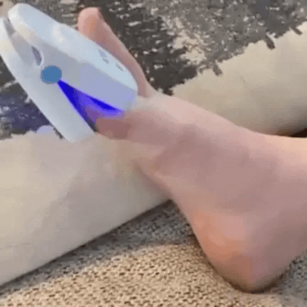 Thuis Laser Behandeling Voor Schimmelnagels NexaLume