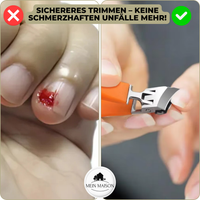 Nagelknipper WideTrim | Extra Brede Snijklep | Anti-Spat Ontwerp | Roestvrij Staal
