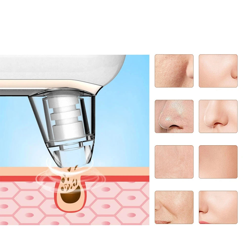 PureGlam | Vacuümtechnologie voor de T-zone voor een gladde, vette huid
