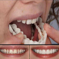Fitflex Opzet Gebit