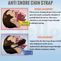 Anti-Snurken Stop Snurken Kinbandriem