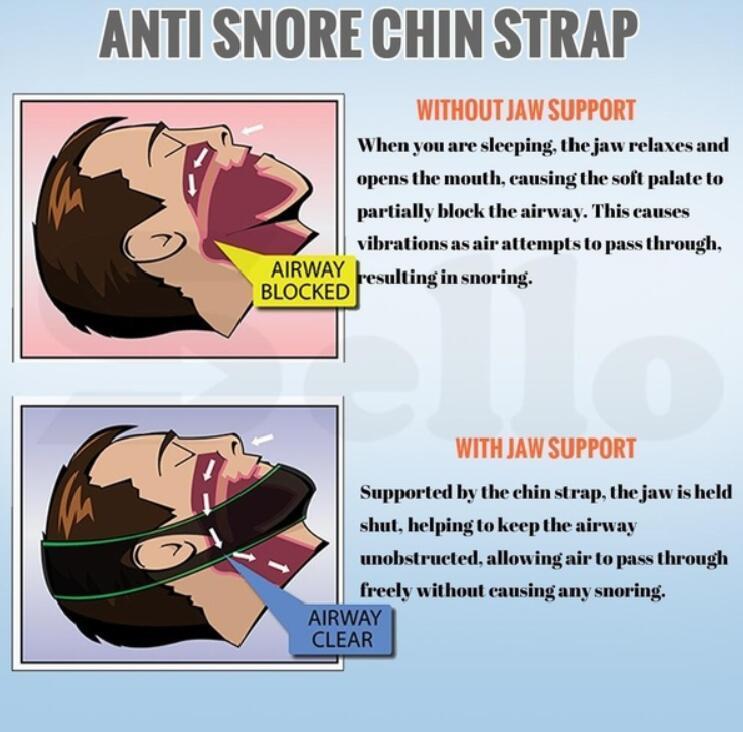 Anti-Snurken Stop Snurken Kinbandriem