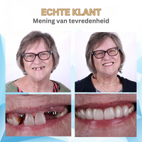 Bikenda | Ervaar het comfort van een kunstgebit voor een fractie van de prijs