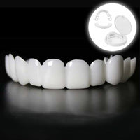 SmileSnap | Directe Veneer Transformatie Kit voor Esthetische Tandbedekking