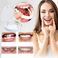 SmileSnap | Directe Veneer Transformatie Kit voor Esthetische Tandbedekking