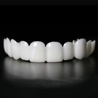 SmileSnap | Directe Veneer Transformatie Kit voor Esthetische Tandbedekking