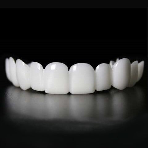 SmileSnap | Directe Veneer Transformatie Kit voor Esthetische Tandbedekking