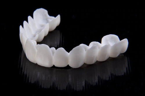 Tandfacetten DentAlign – Natuurlijke Aanpassing en Comfort