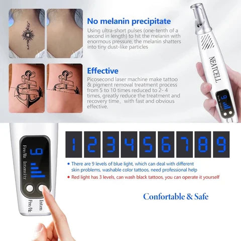 LumiDerm Thuis Laser Pen Voor Het Verwijderen Van Tattoos, Moedervlekken En Vlekken