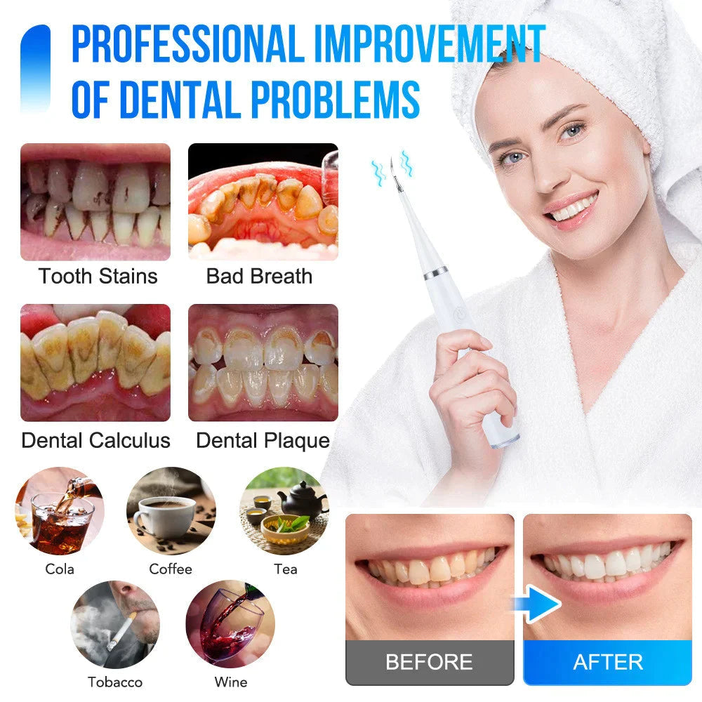 ToothCleaner – Ultrasone Tandenreiniger voor grondige mondverzorging