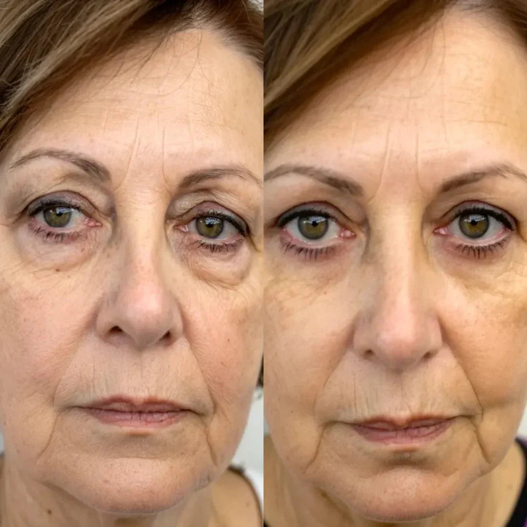 LumaNova Oogverjonger voor Roodlichttherapie en Microcurrent