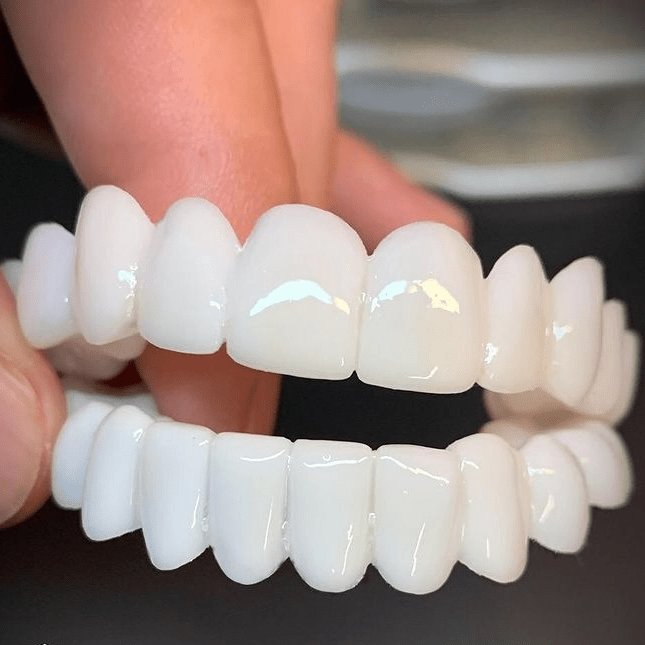 SmileFlex – Aanpasbare tandprothese met tandlenzen