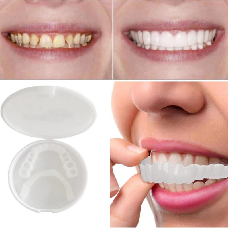 Titania - Snap-On Protheses | Altijd de Perfecte Glimlach