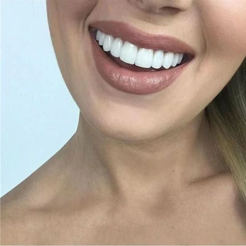 SNAPFIT SMILE – Tandrestauratie voor een perfecte glimlach zonder tandarts