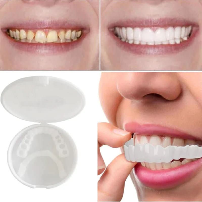SNAPFIT SMILE – Tandrestauratie voor een perfecte glimlach zonder tandarts