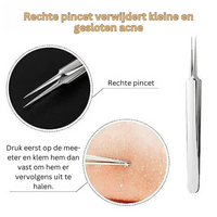 ClearSkin | Geeft je de kracht om zelfs de hardnekkigste mee-eters en acne gemakkelijk te verwijderen