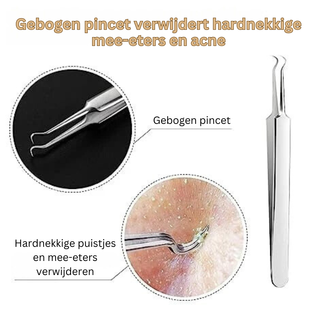ClearSkin | Geeft je de kracht om zelfs de hardnekkigste mee-eters en acne gemakkelijk te verwijderen