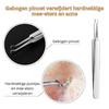 ClearSkin | Geeft je de kracht om zelfs de hardnekkigste mee-eters en acne gemakkelijk te verwijderen