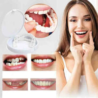 Tandprothese | Directe Glimlach zonder Lijm | Flexibele Pasvorm | SmileSnap