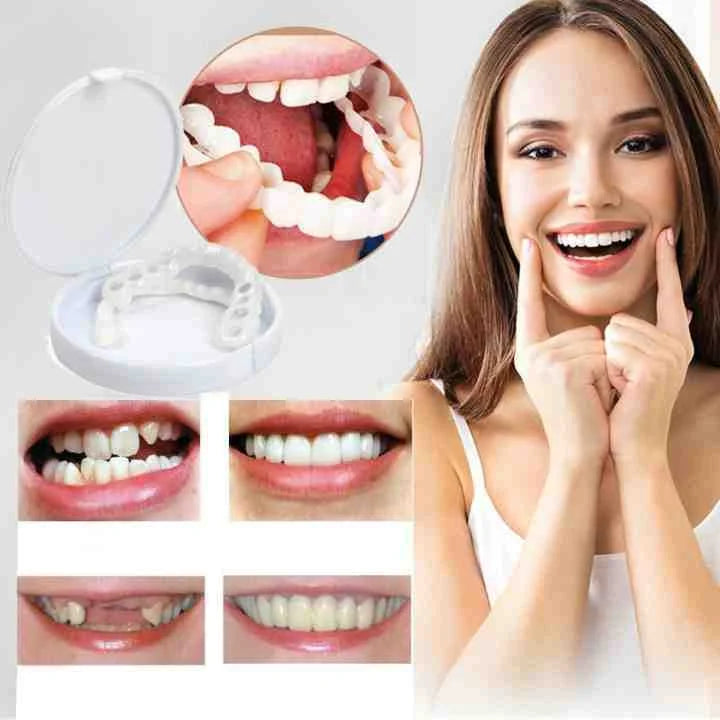Tandprothese | Directe Glimlach zonder Lijm | Flexibele Pasvorm | SmileSnap