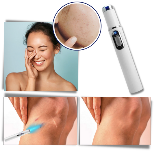 DermaPure | Draagbare lasertherapie voor een heldere teint